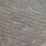 中医揪痧绿色疗法